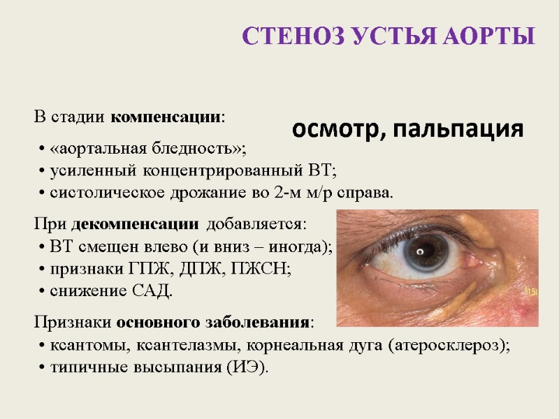 осмотр, пальпация В стадии компенсации:  • «аортальная бледность»;  • усиленный концентрированный ВТ;